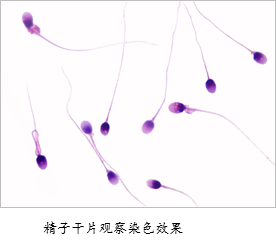 精子\/ 血细胞染色试剂盒(紫罗兰一步染色法)