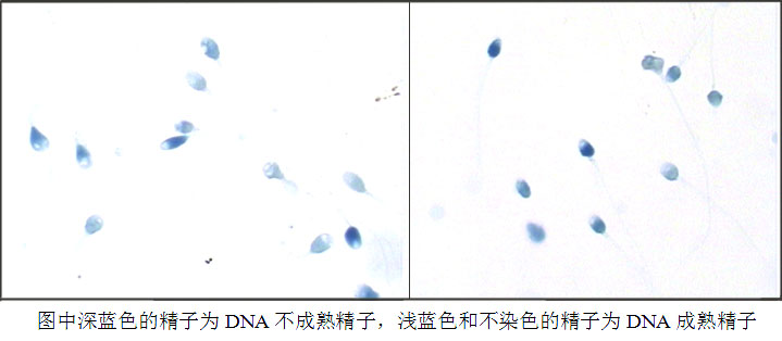 产品名称:精子核蛋白染色(苯胺蓝染色液)